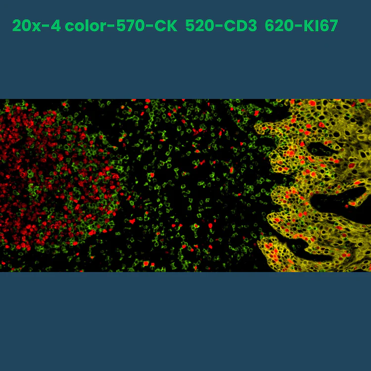 4-color multiplex fluorescence IHC detection kit (rabbit-on-rodent)