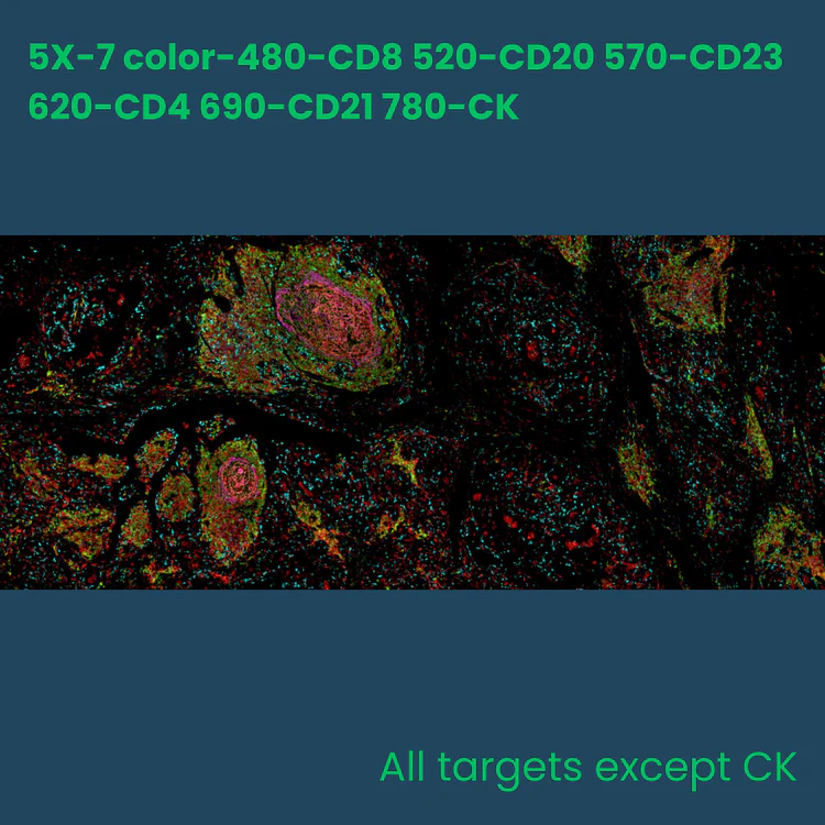 7-color multiplex fluorescence IHC detection kit (rabbit-on-rodent)